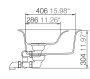 Schock Genius C-150 A Einbau/Auflage, Nero